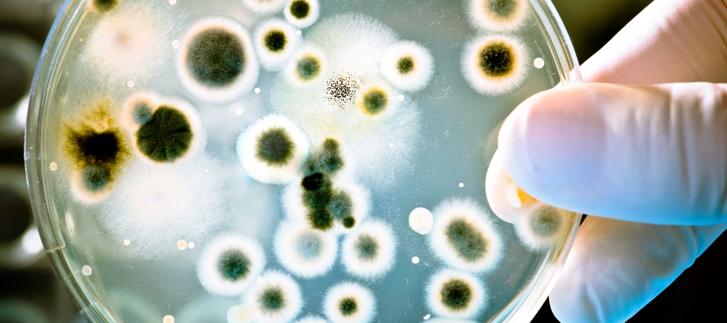petri dish with growing organisms in it; Health science program