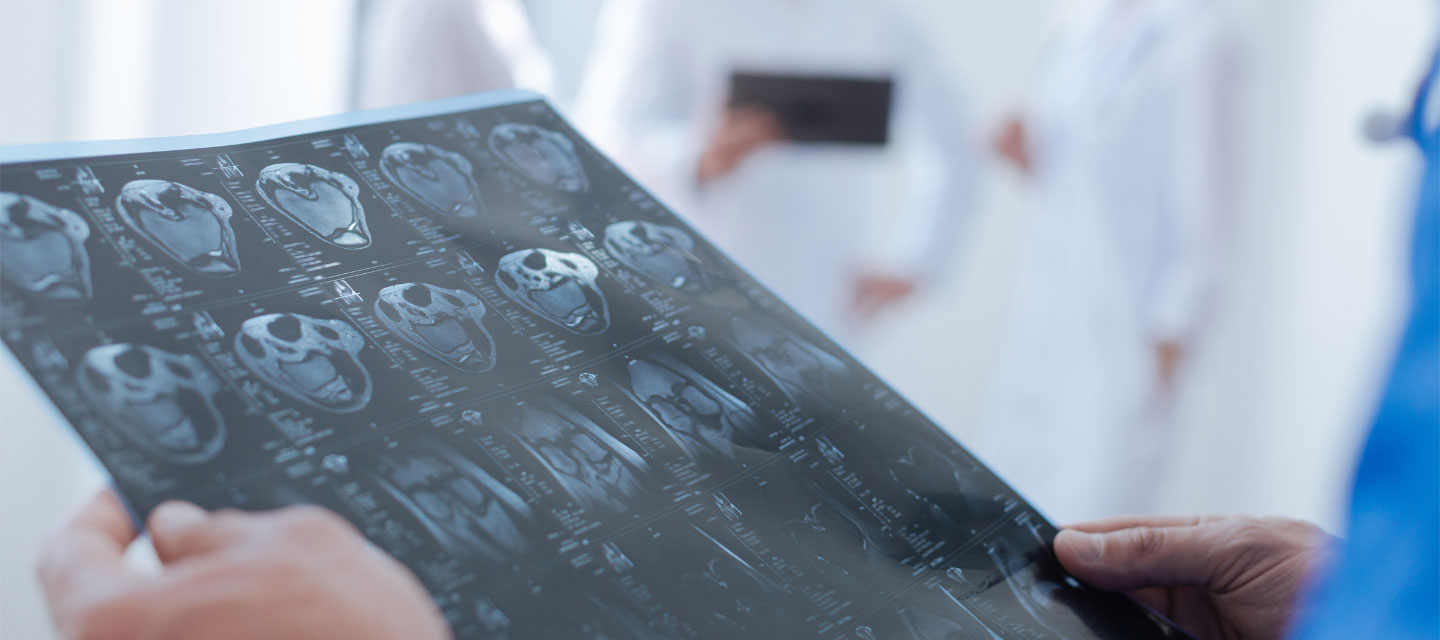 hands holding up images of skull for person to review; nuclear medicine technology