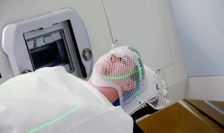 radiation therapy